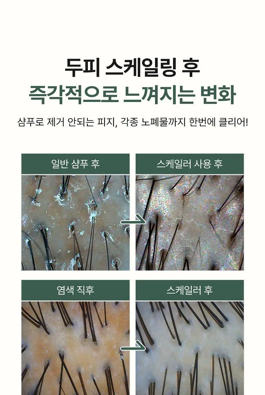 [두피 스케일링]피지/각질/냄새 전문가케어 솔랩 아쿠아픽 두피스케일러 250ml + 브러쉬 기획 상세페이지 21